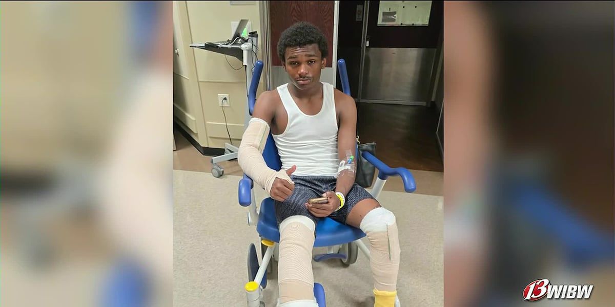 Kansas Teen Suffers Third-Degree Burns Bravely Saving Family from House Fire